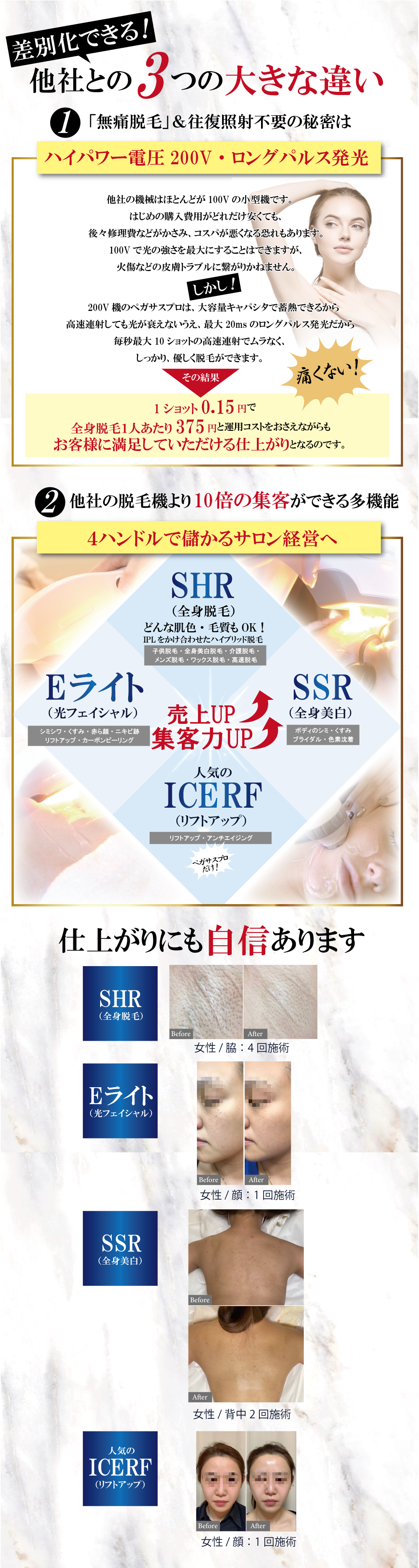 脱毛機の違い。無痛脱毛。4ハンドル。