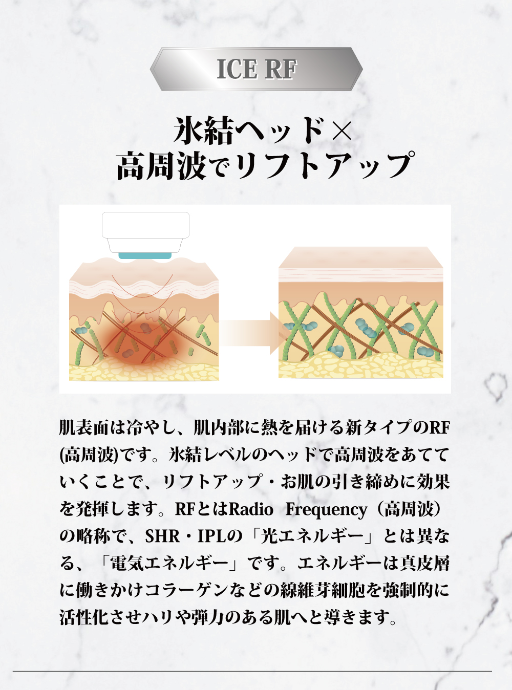 05-ICERF-01メンズ2024